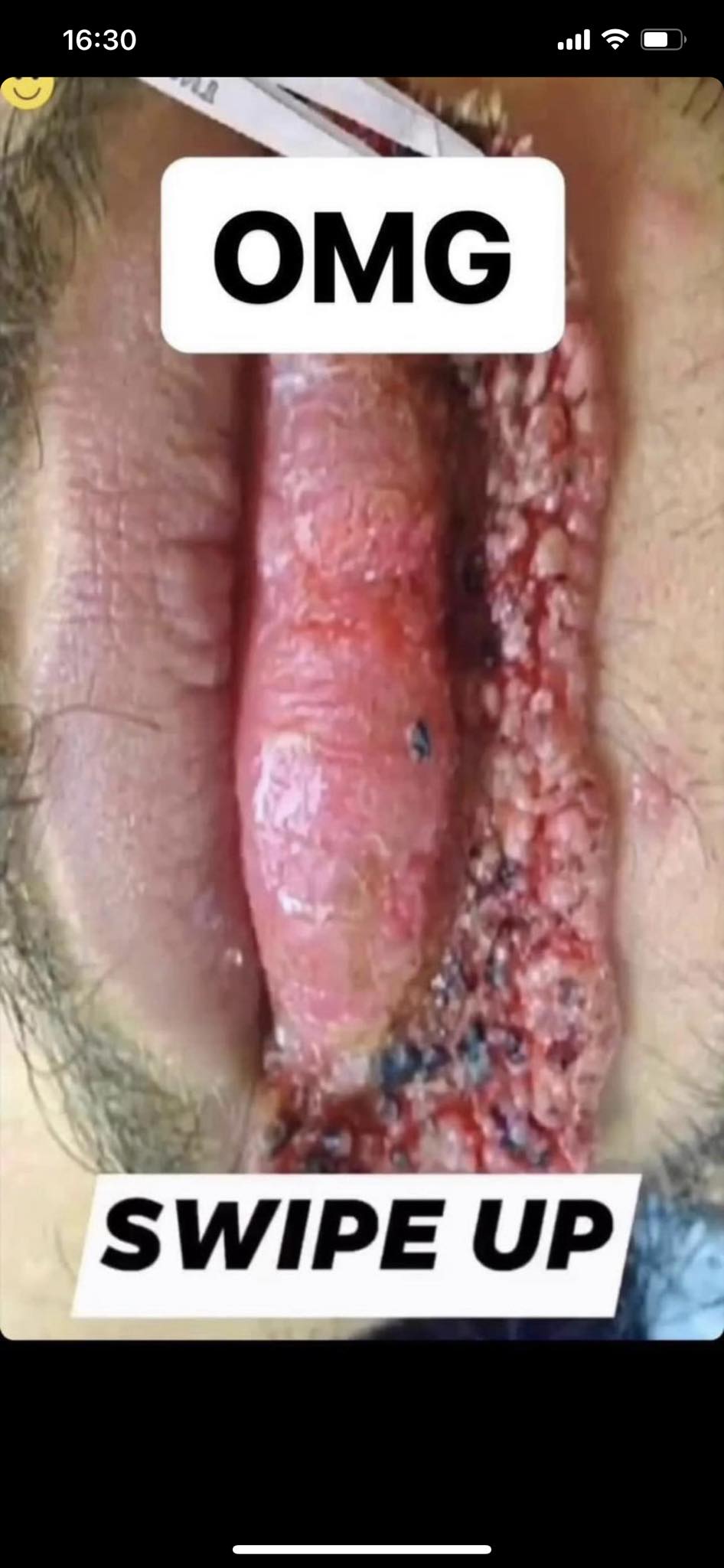 8 Body Symptoms You Should Be Aware Of