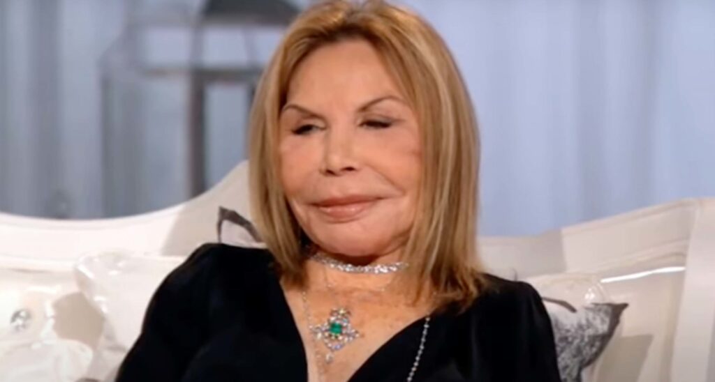 The Shocking Plastic Surgery Transformation Of Elsa Patton