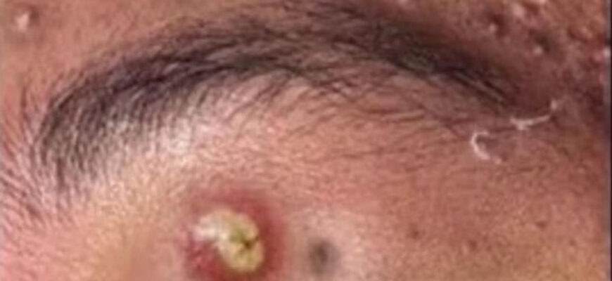 Symptoms That Your Body Is Not Right