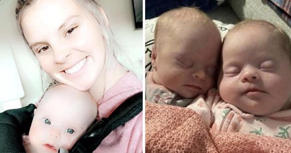 The Special Journey of Savannah and Her Twins with Down Syndrome