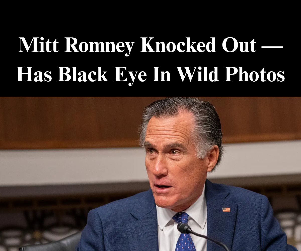 Mitt Romney Knocked Unconscious, Suffers a Black Eye After Fall